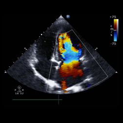 Echocardiogram Echocardiogram